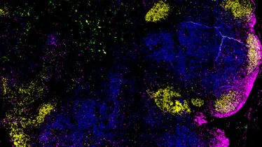 增强免疫系统、提高身体疾病防御力的指南